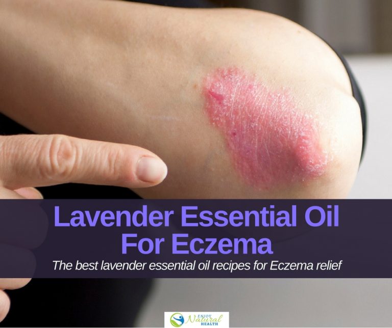 The 4 Best Lavender Oil For Eczema Relief Recipes Enjoy Natural Health